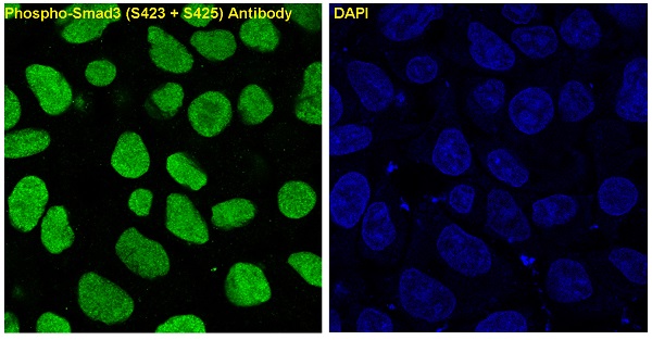 IF - Anti-Phospho-Smad3 (S423 + S425) Rabbit Monoclonal Antibody ABO13199
